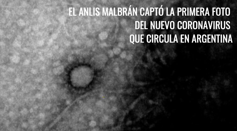 La vista microscópica que obtuvo el Malbrán (@ginesggarcia)