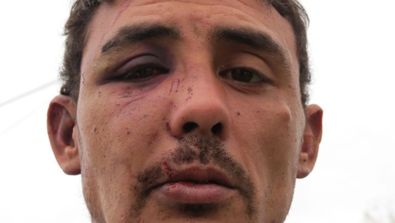 Secuelas de los golpes sufridos por Sebastián D. a manos de los policías.