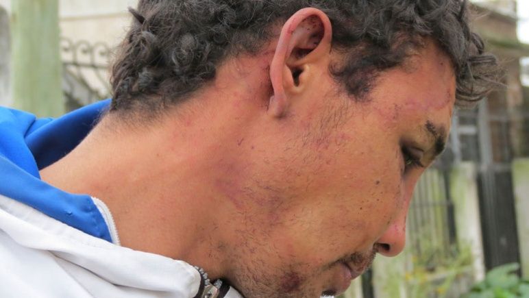 Secuelas de los golpes sufridos por Sebastián D. a manos de los policías.