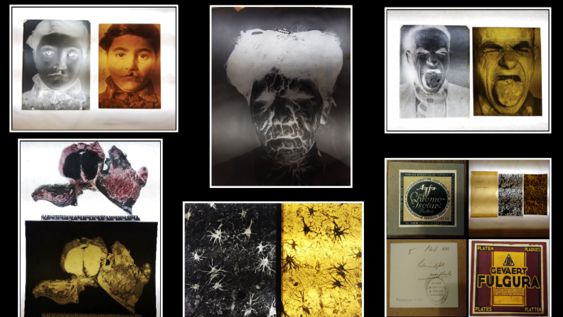 Tras un hallazgo histórico, analizan crear un museo sobre viejas enfermedades rosarinas
