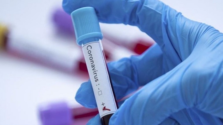 Coronavirus: sólo un positivo en Casilda pero 295 sospechosos