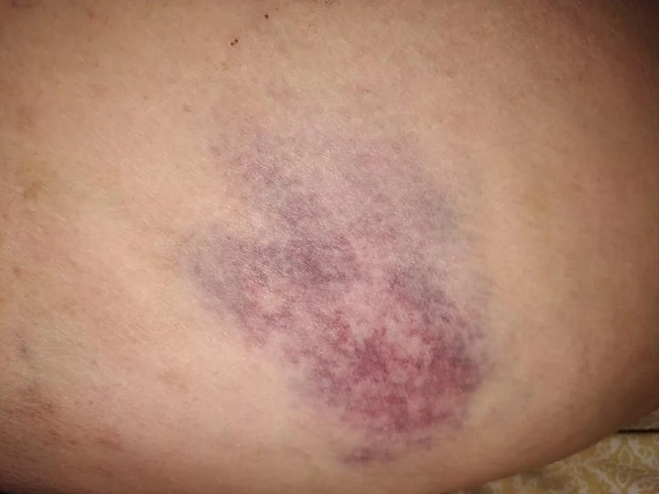 Las imágenes que datan los golpes.