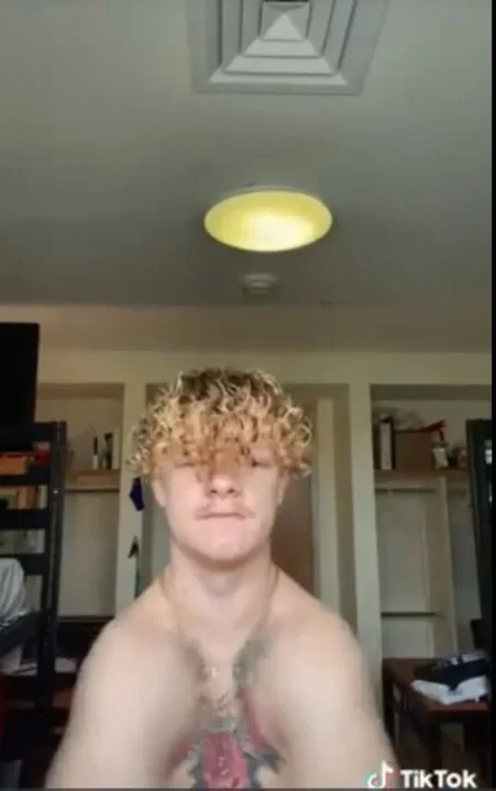 Nació sin clavículas y la rompe en Tik Tok aplaudiendo con los hombros