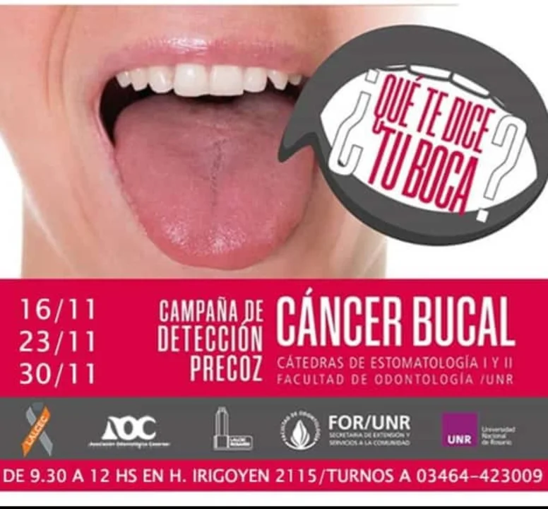 Comienza la Campaña de Detección del Cáncer Bucal