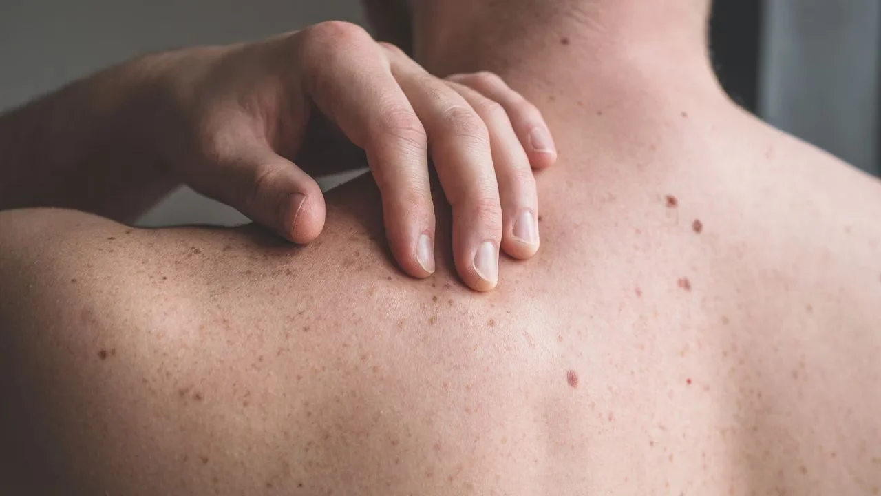 Cáncer: se detectan más de 1600 casos por año en Rosario