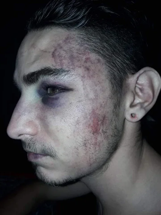 Una de las víctimas de la brutalidad policial.